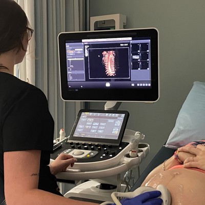 USI DMS Program offers free pregnancy ultrasounds   - News article image