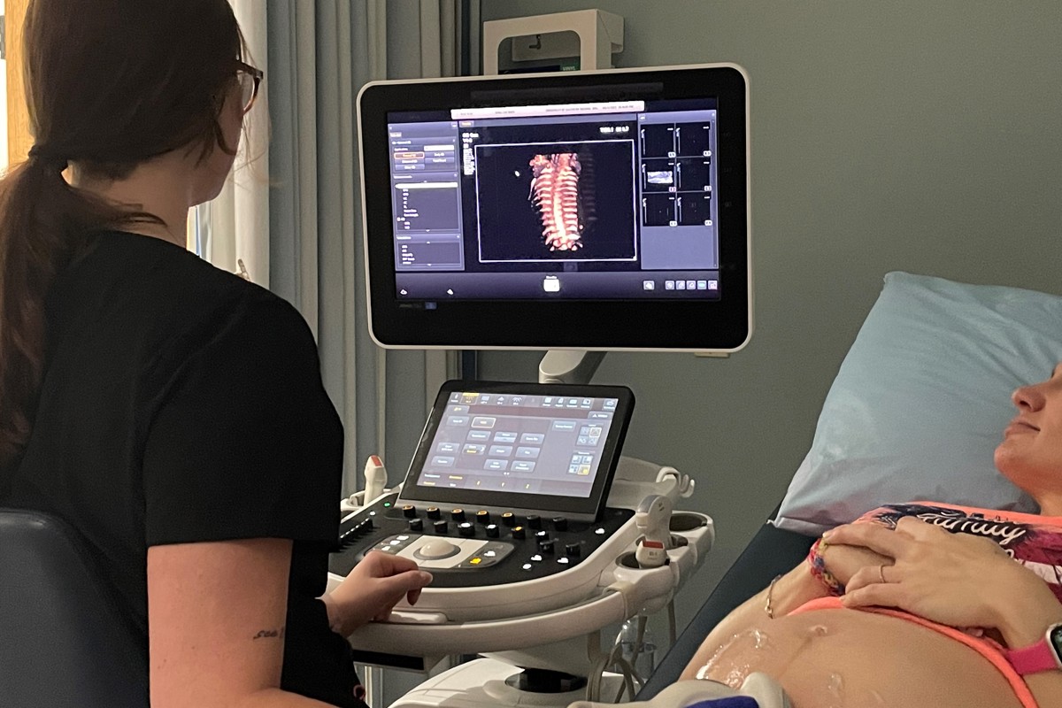 USI DMS Program offers free pregnancy ultrasounds  